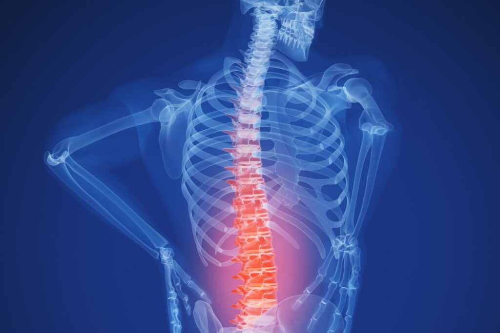 Discopathie L5-S1 et invalidité : peut-on toucher une pension ?

